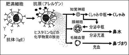 アレルギー性鼻炎 北海道 帯広 十勝 社会医療法人北斗 北斗病院 北斗クリニック