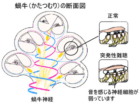 耳 詰まっ た 感じ 片方