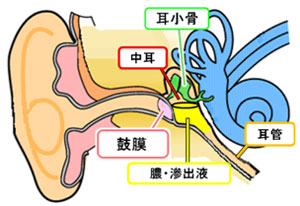 耳 水 抜け ない