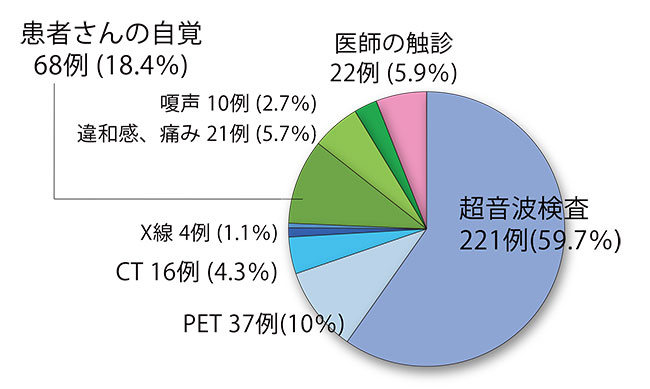 北斗病院 甲状腺のしこり発見のきっかけ