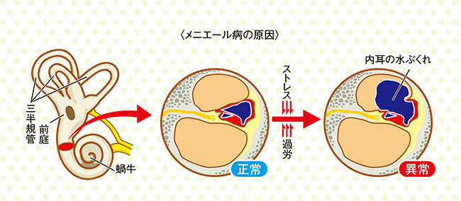 レイノー症候群になる人