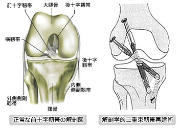 ４ 前十字靭帯損傷 北海道 十勝 帯広 整形外科専門医 石田 直樹医師 オフィシャルサイト 北斗クリニック 関節センター